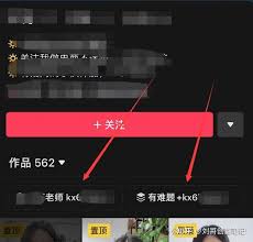 震惊！抖音留微信号竟有如此巧妙技巧，速戳！